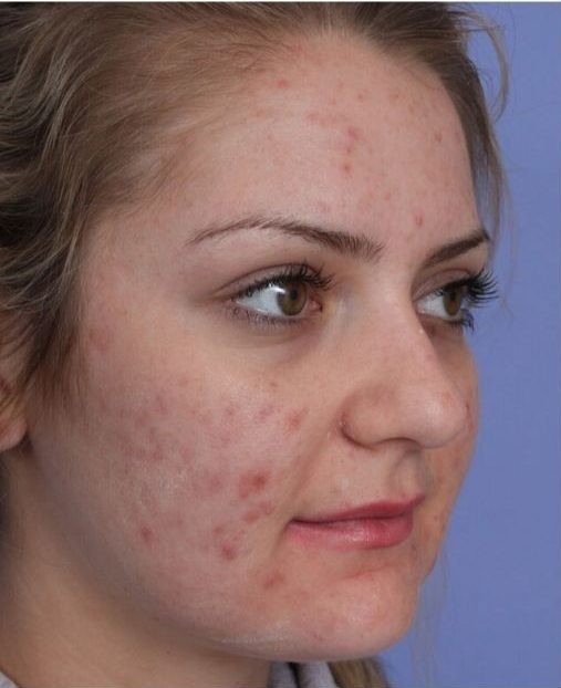 Centre massage Tunis – Soin visag Centre Massage Tunis | Lilac Beauté le Meilleure Manzah 6