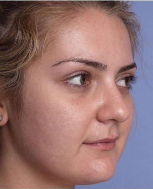 Centre massage Tunis – Soin visage Centre Massage Tunis | Lilac Beauté le Meilleure Manzah 6